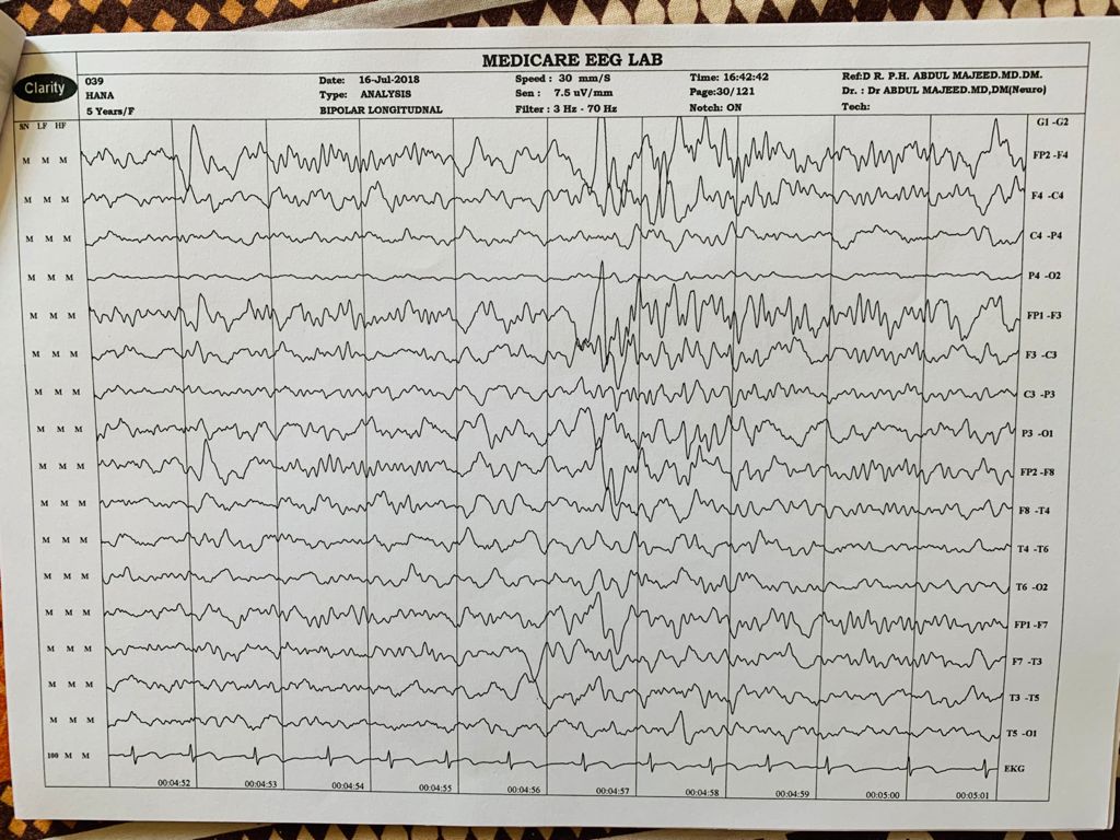 Patient Story